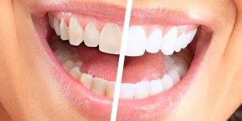Best Dental Clinic For Orthodontic Treatment in Cranbrook