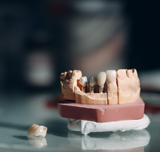 Oral Hygiene Tips